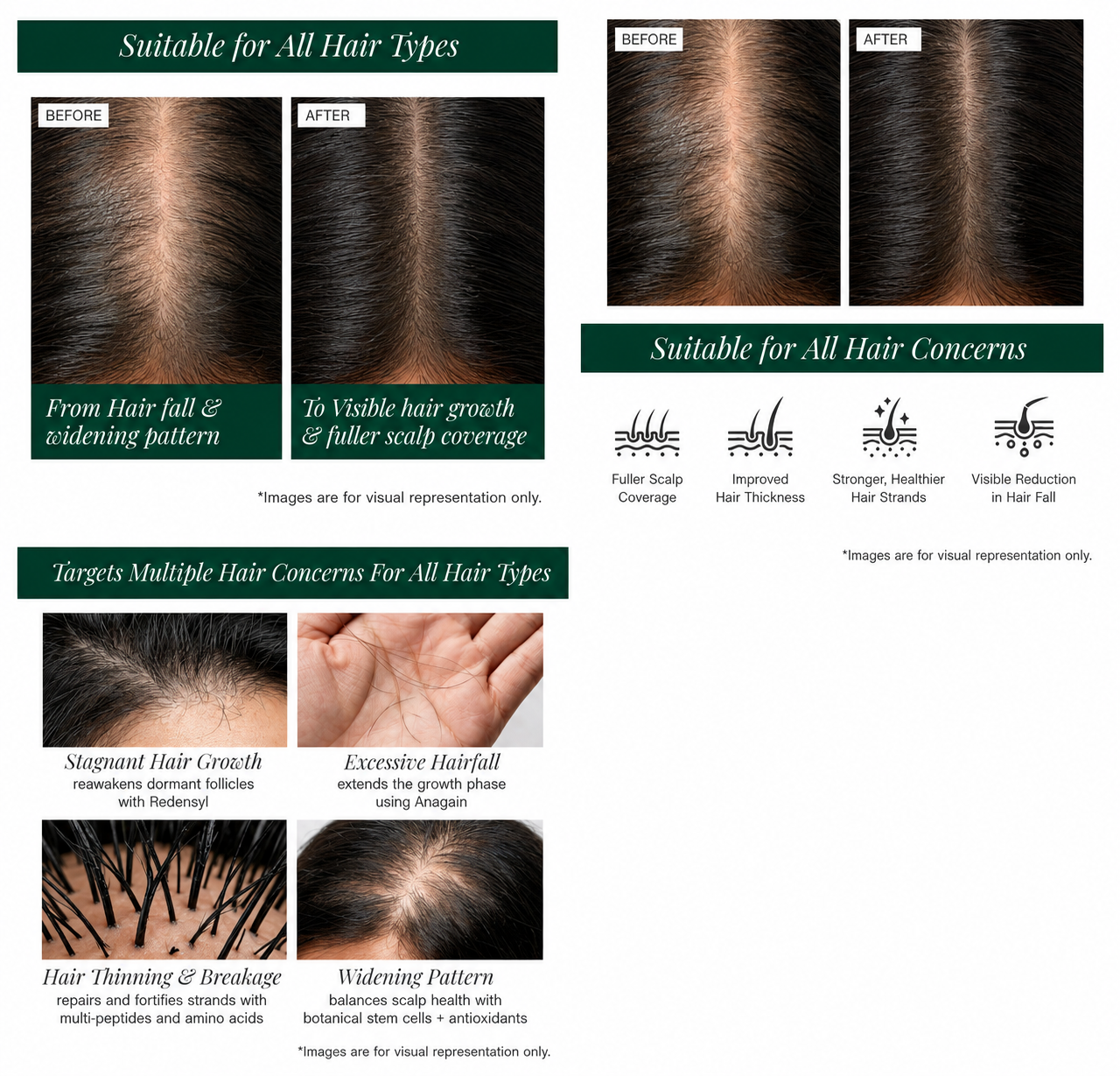 Stemcells + Multi-Peptide Hair Growth Serum Fortified With Redensyl & Anagain