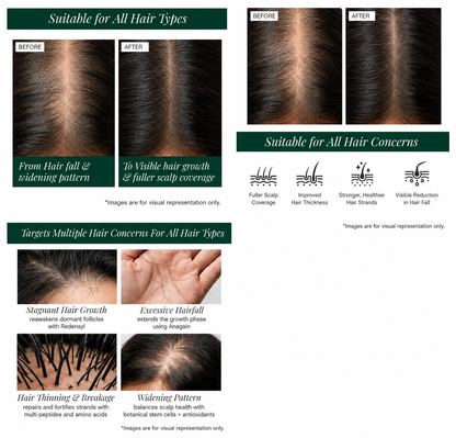 Stemcells + Multi-Peptide Hair Growth Serum Fortified With Redensyl & Anagain